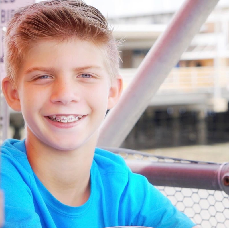 Orthodontics Gastonia Premier Dental Associates