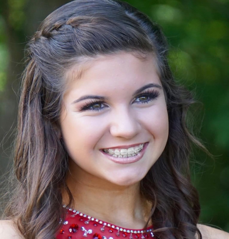 Orthodontics Gastonia Premier Dental Associates