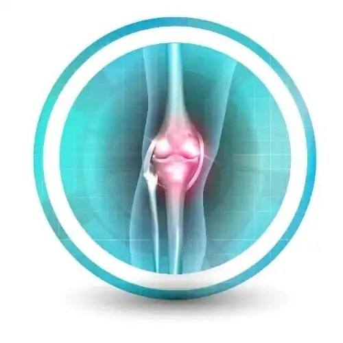 Osteoarthritis Treatment Osteoarthritis Doctor Near Me Pedes OC, CA