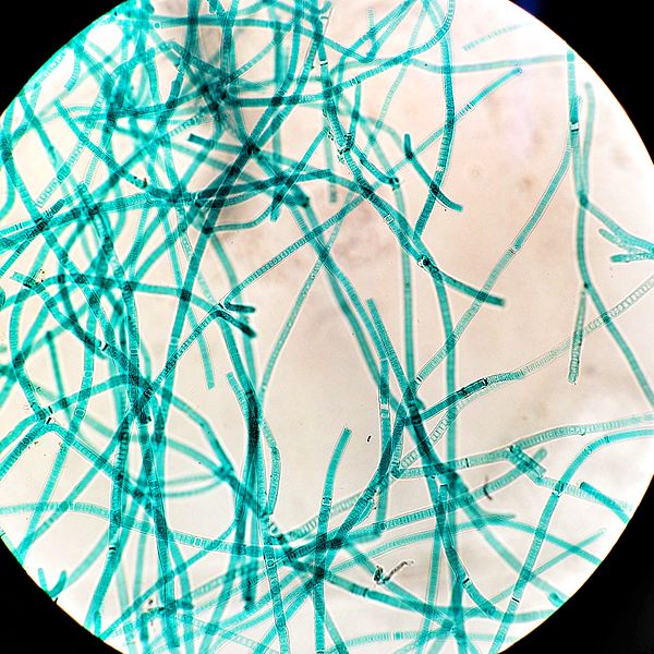 Difference Between Monera and Protista Characteristics