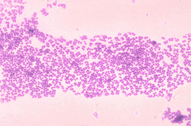 Difference Between Micrococcus and Staphylococcus