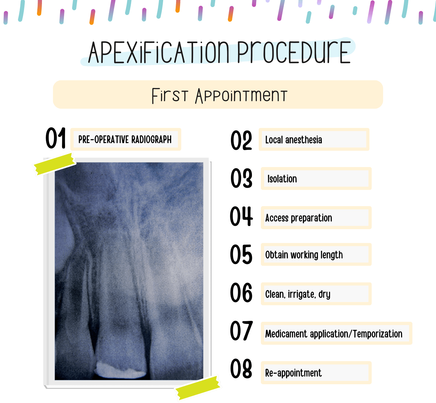 Apexification Procedure Pediatric Dentistry Workbook