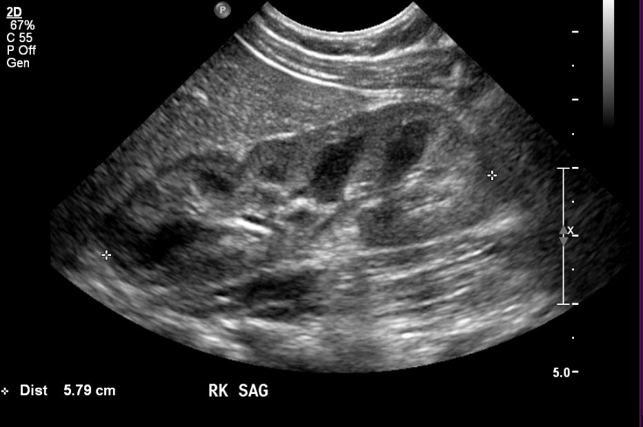 Imaging of the Urinary Tract Pediatric Urology Book