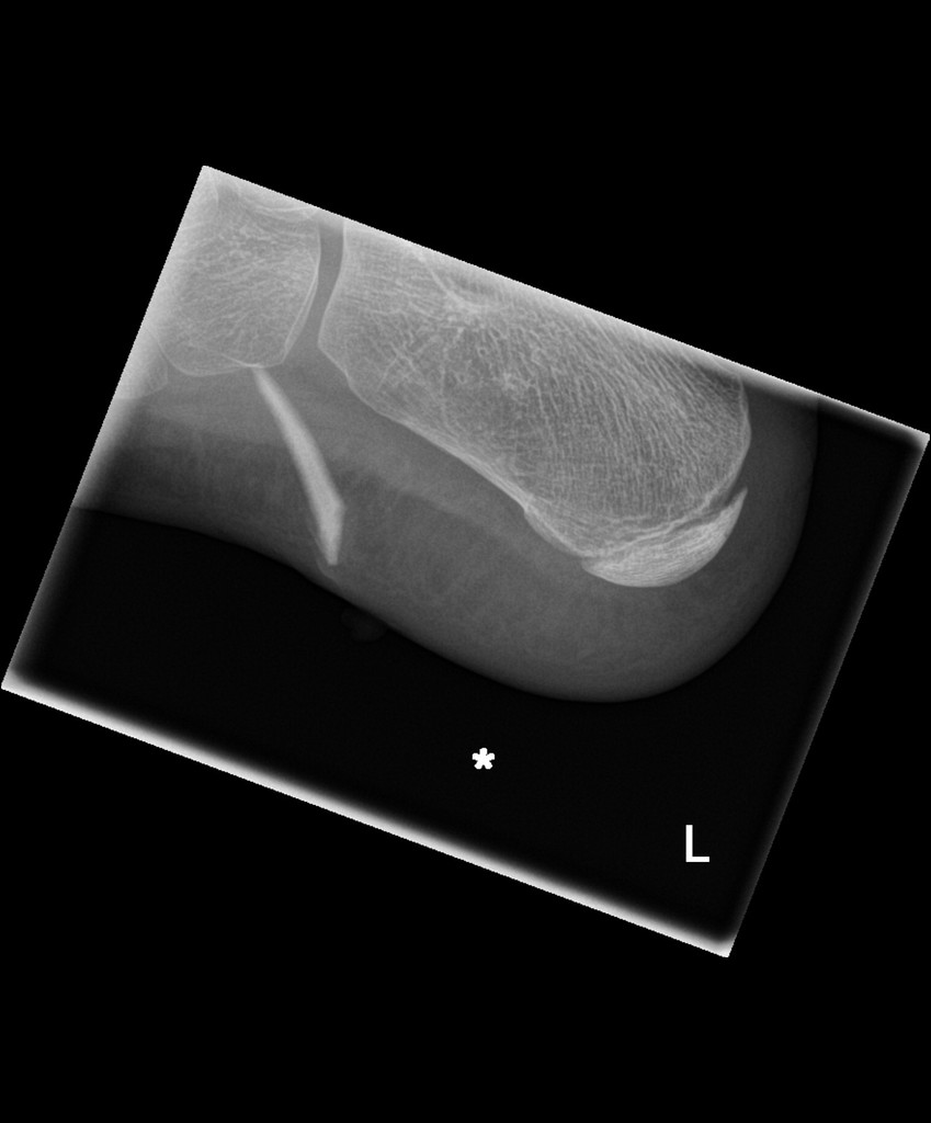 skin trauma Pedmore Medical