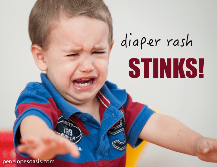 Diaper Rash Stinks! DESITIN ChangeForTheBetter » Penelopes Oasis
