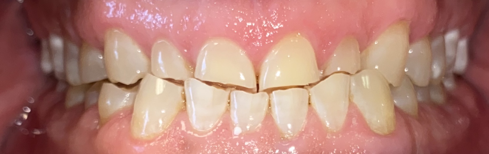 Gallery Penn Dental and Implant Center Dentist in Dallas