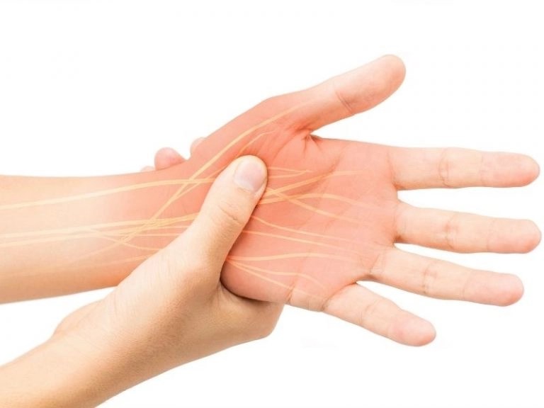 Common Nerve Pain Points Diffuse Nerve Pain Pennsylvania Pain