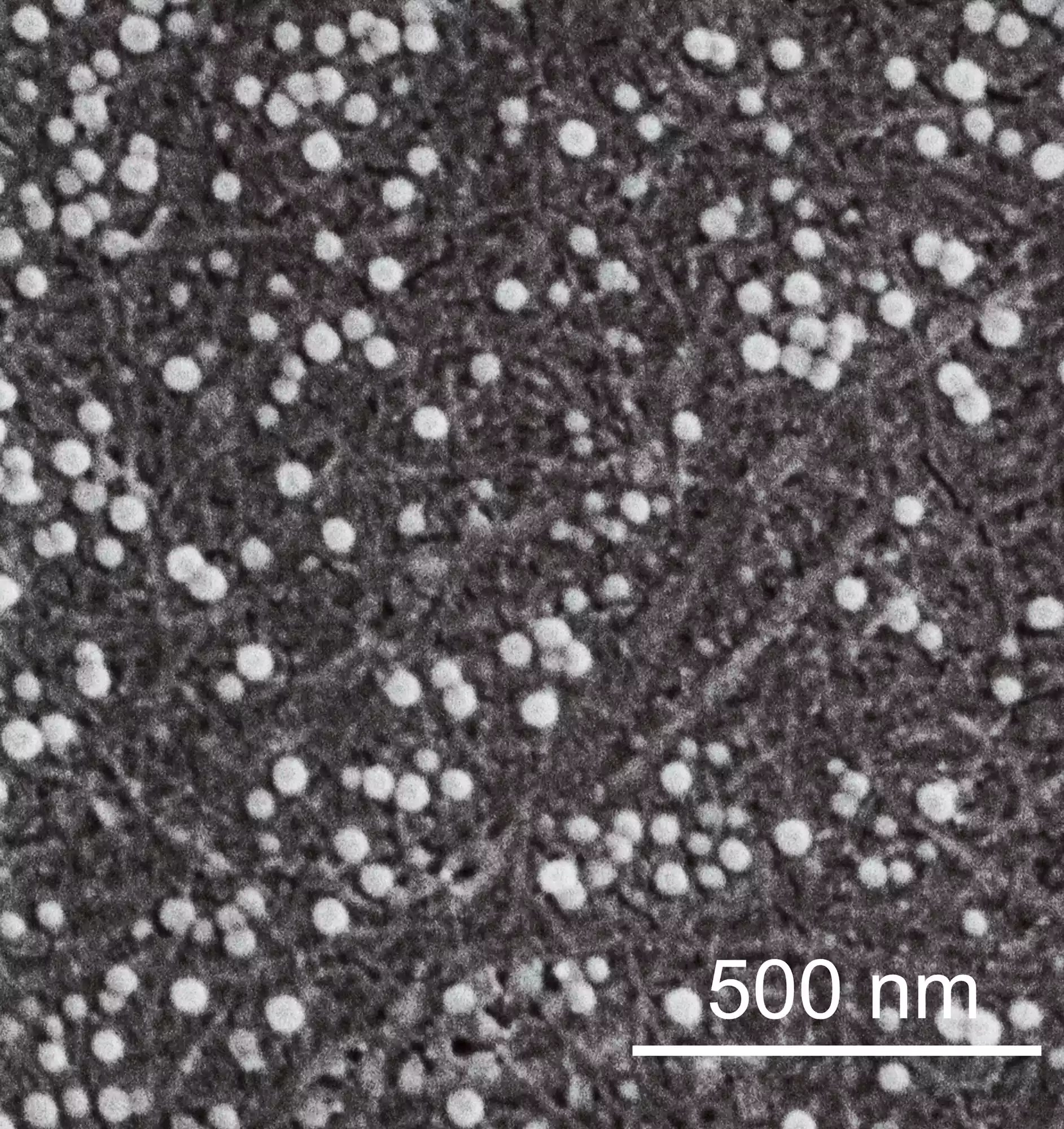 Micro photo of a microplastic filter. Looking at filtered plastic particles on surface of our gel filter membrane. The white round particles are plastics, about 30-50 nanometers.
