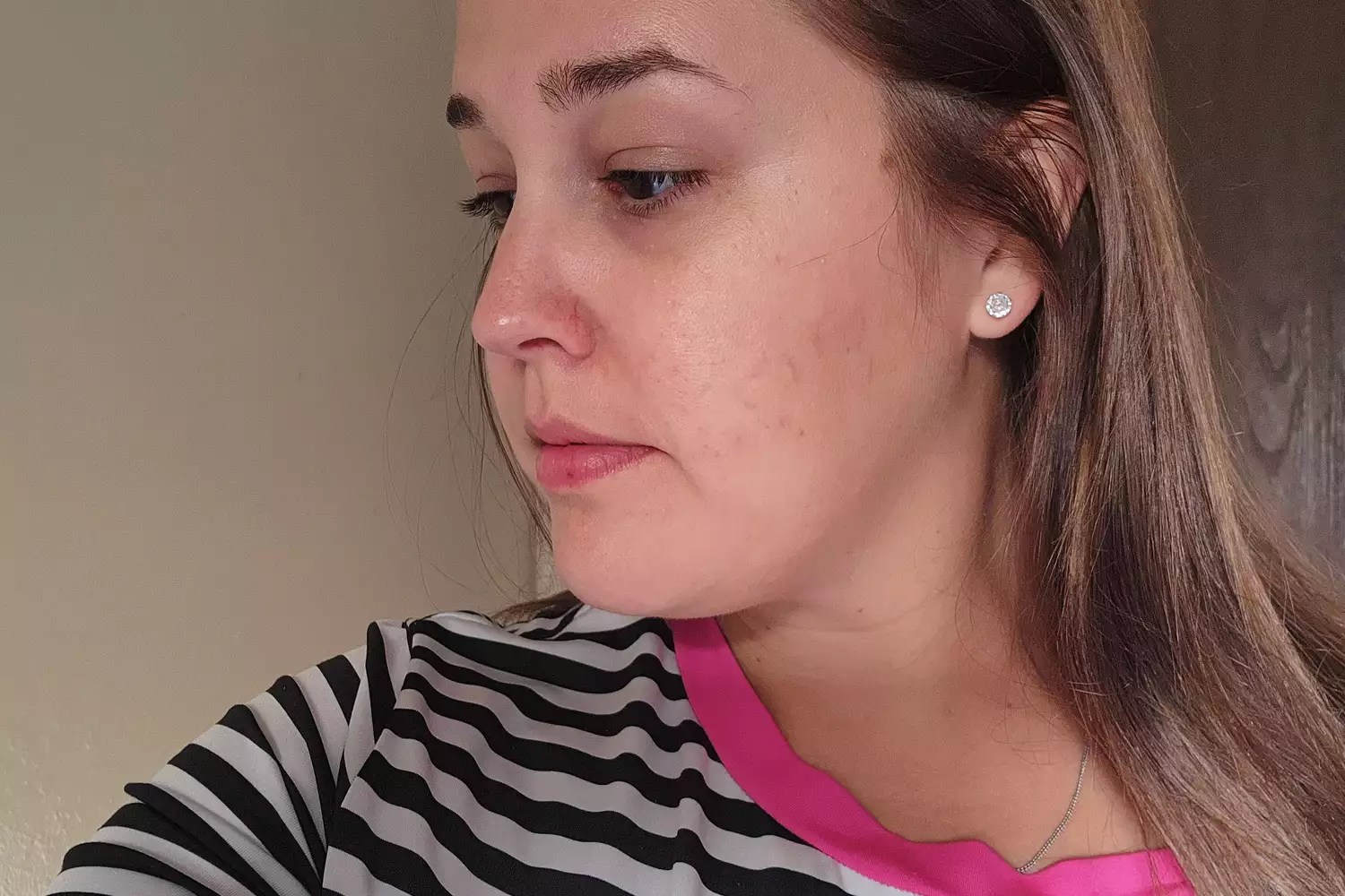 A person after using the evertone Everlift Microcurrent Device + Free Activating Serum