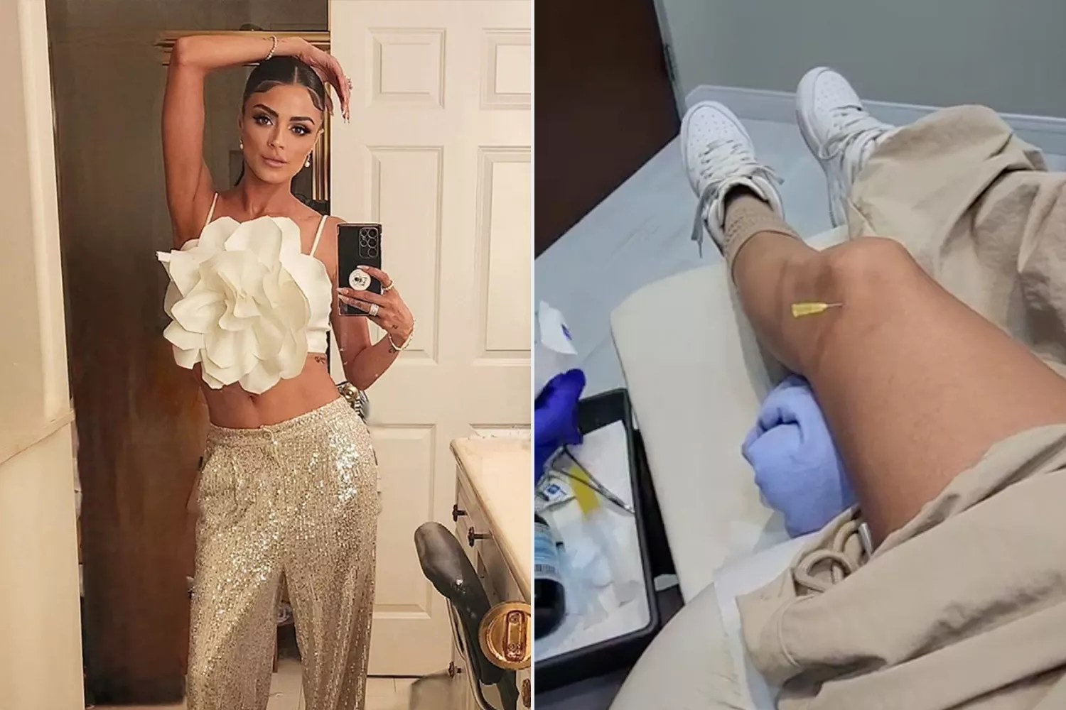 Golnesa âGGâ Gharachedaghi Documents &lsquo;Rough&rsquo; Treatment for Her Rheumatoid Arthritis: &lsquo;Never Easy&rsquo;