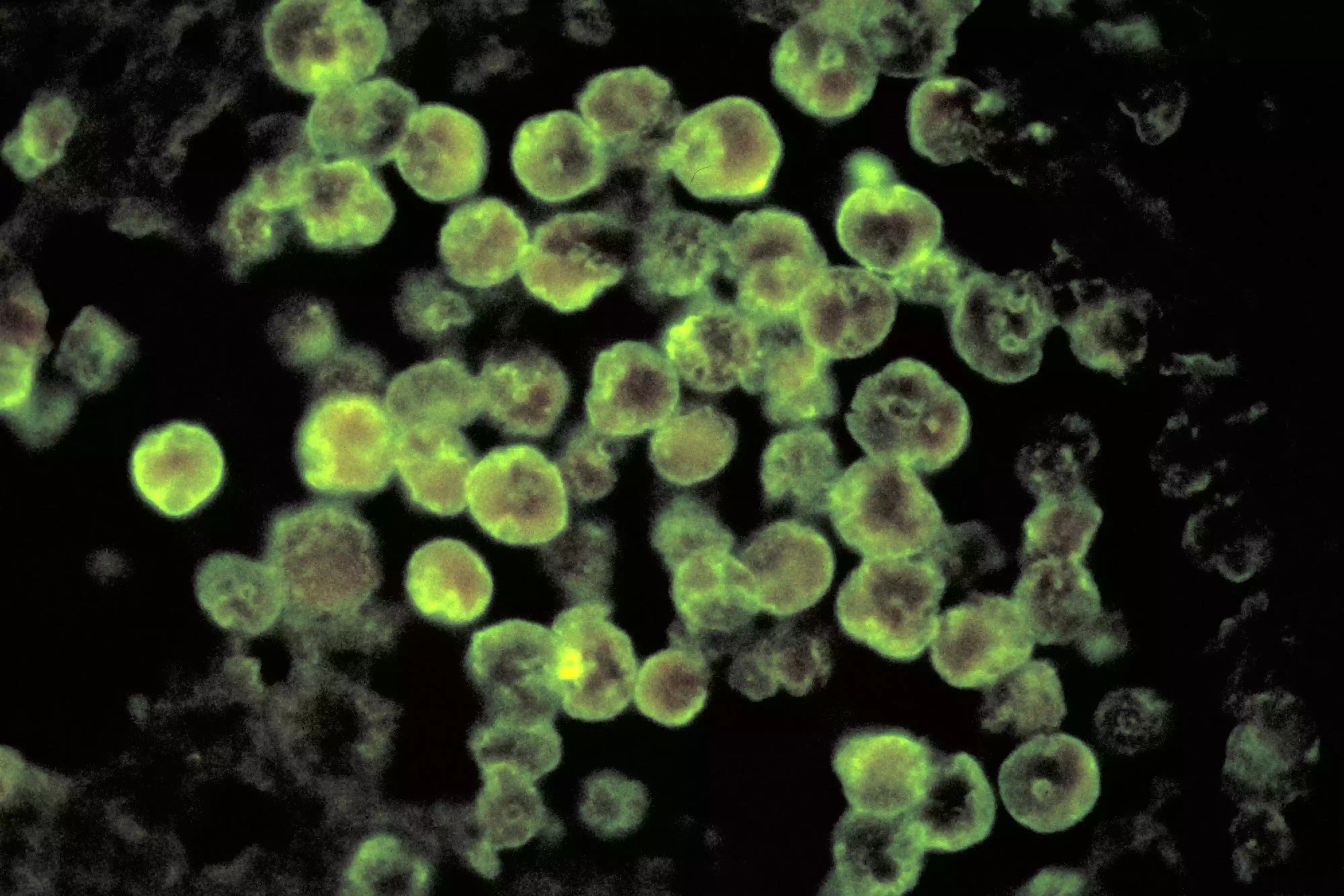Brain-eating amoeba