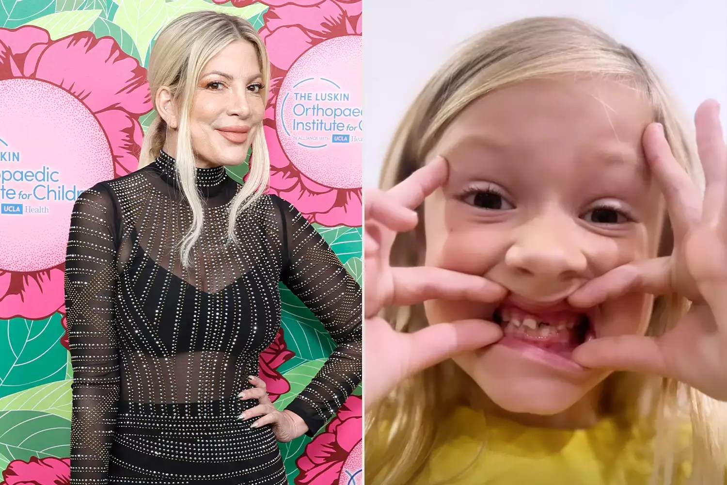 Tori Spelling Reveals That Son Beau, 6, &lsquo;Lost His First Tooth Tonight&rsquo; in Sweet Update/