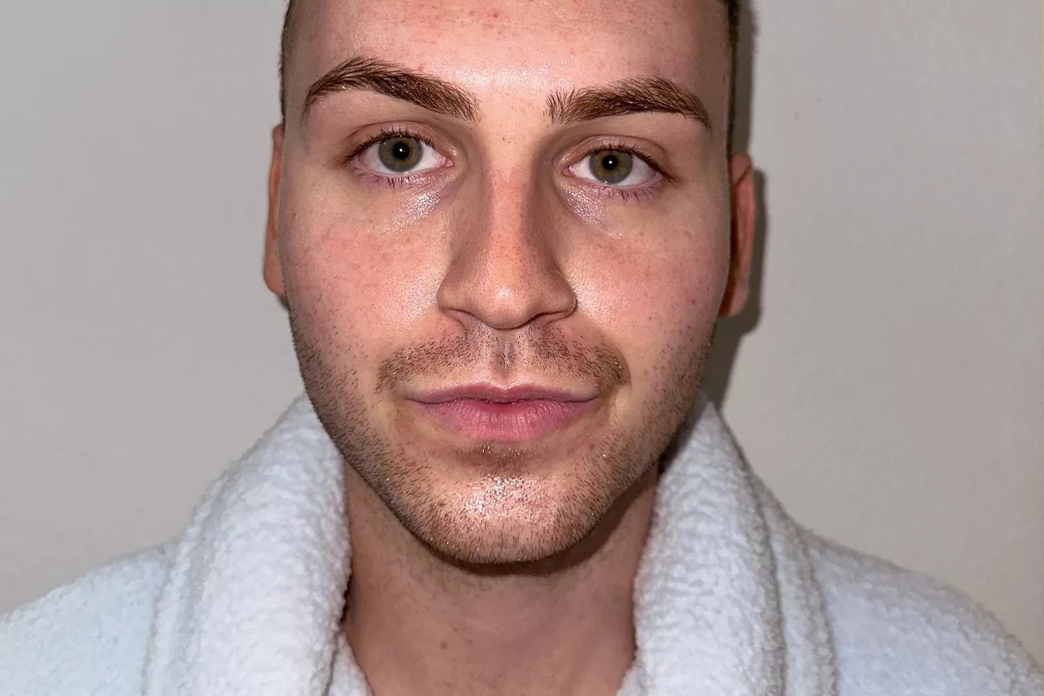 A person&rsquo;s face after using the TheraFace Pro