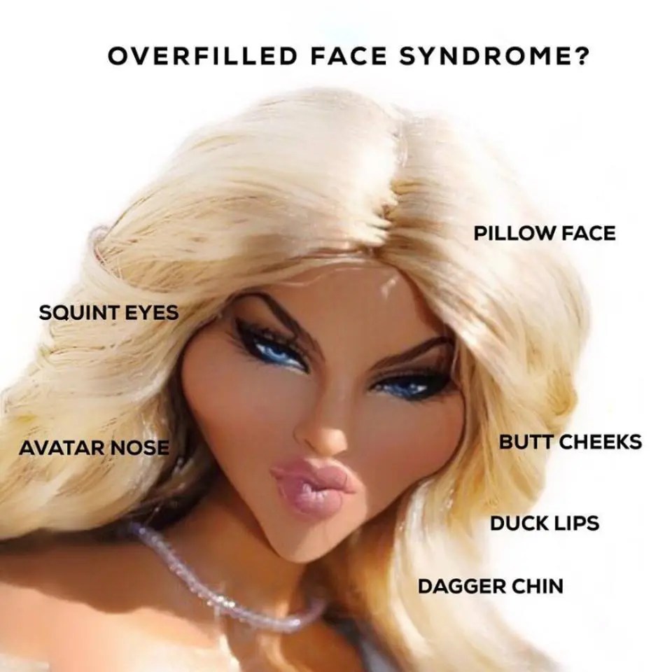 Facial Overfilled Syndrome What it is and how we can help you treat it