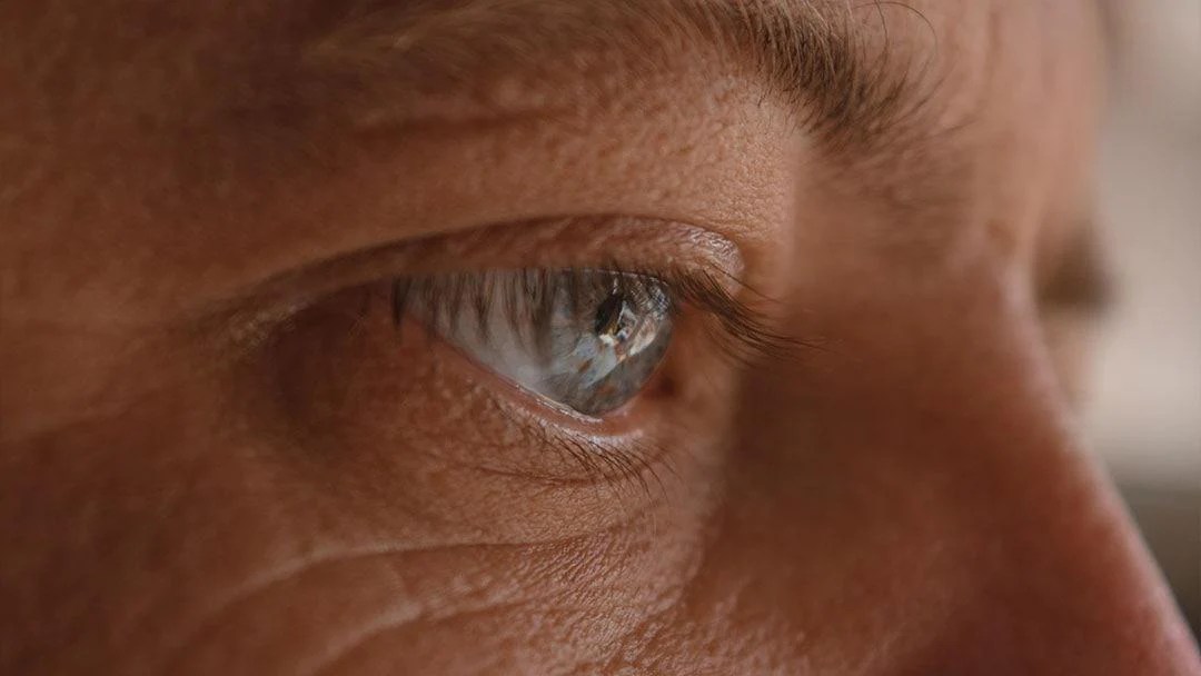 What are Festoons? How to Get Rid of Them Perfect Image