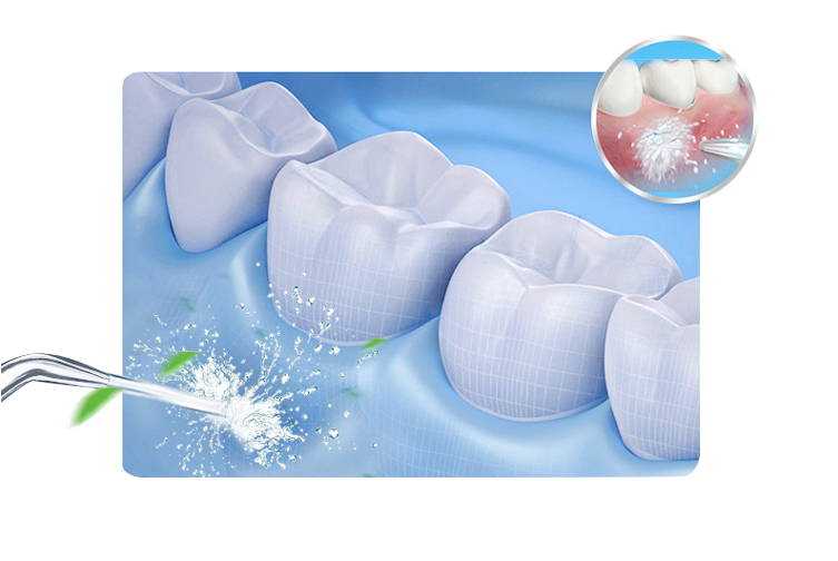 Technology Perfect Smile Water Flosser