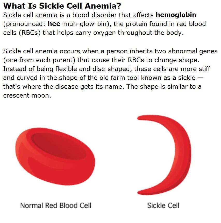Sickle Cell Anemia v1