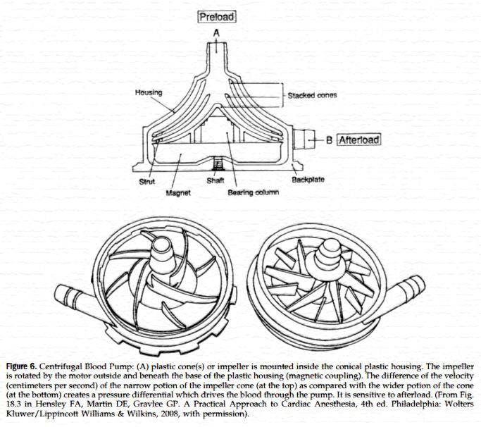 Centrifugal vs. Rollerhead Pump? Which is Safer?