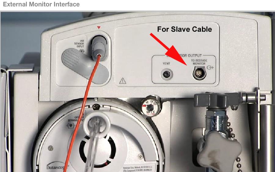 IABP 101 Preparation and Insertion