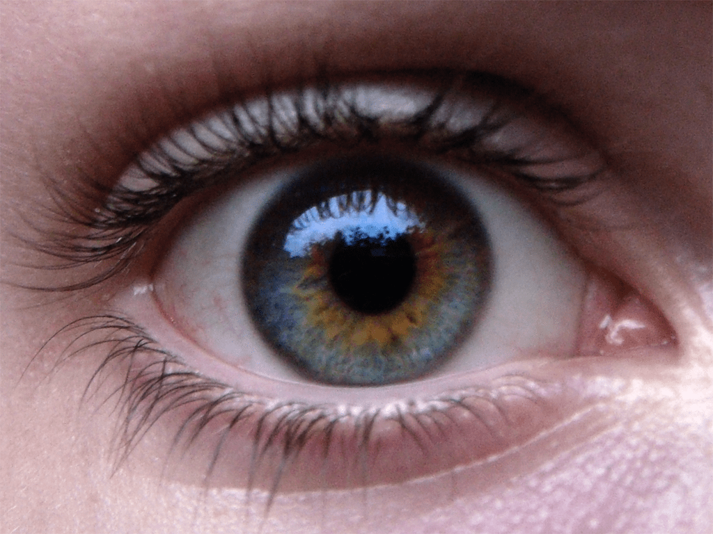 Central_Heterochromia_Example_Blue_&_Brown