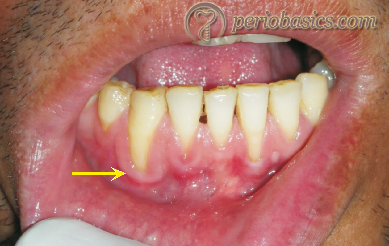 Art of history taking in periodontics