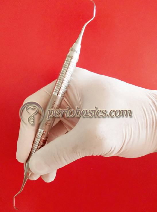 Principles of periodontal instrumentation