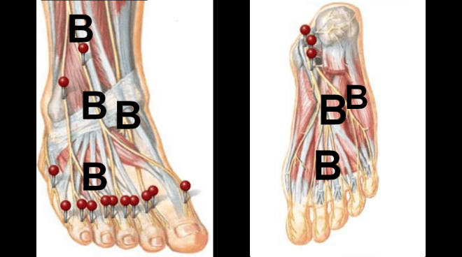 Pain on the top of the foot and ankle by Dr Steven J Dolgoff
