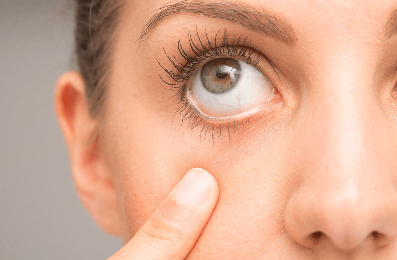 Can Allergies Cause Dry Eyes? Perry Utah