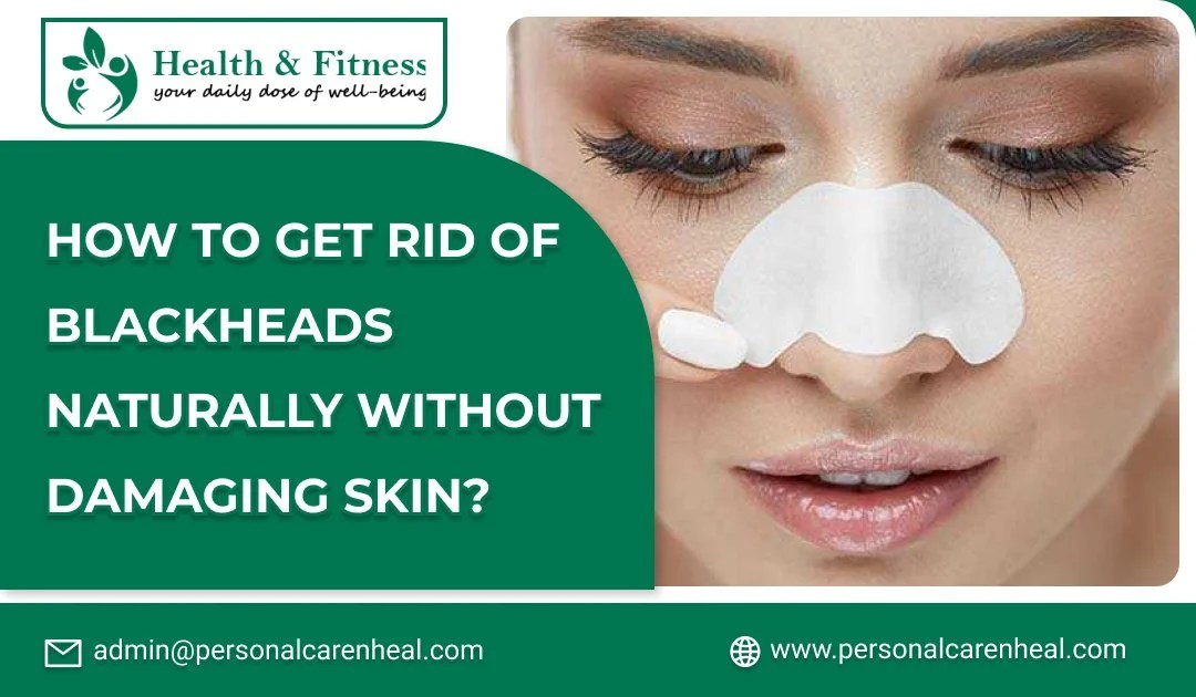 How to Get Rid of Blackheads Naturally Without Damaging Skin?