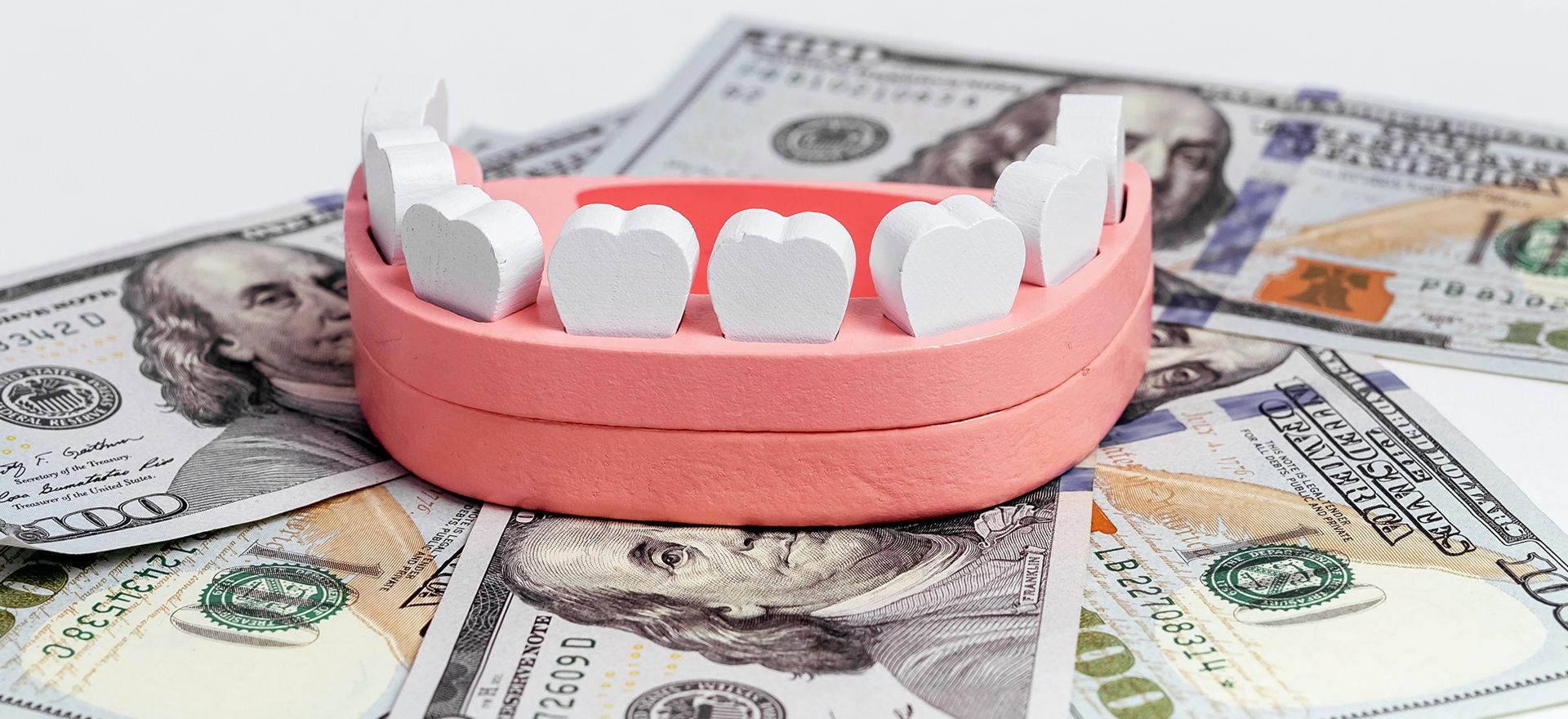 Dental Insurance Columbia Basin Denture Care