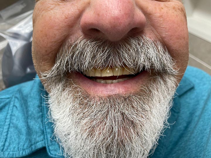 Our Results Columbia Basin Denture Care