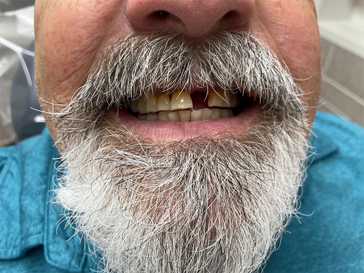 Our Results Columbia Basin Denture Care