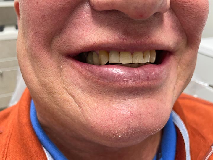 Our Results Columbia Basin Denture Care