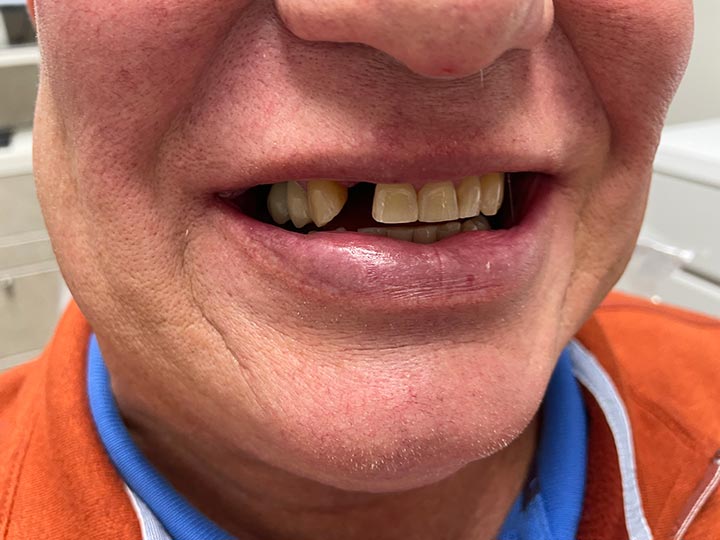 Our Results Columbia Basin Denture Care