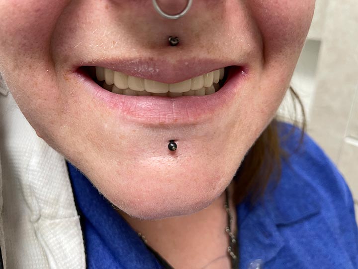 Columbia Basin Denture Care