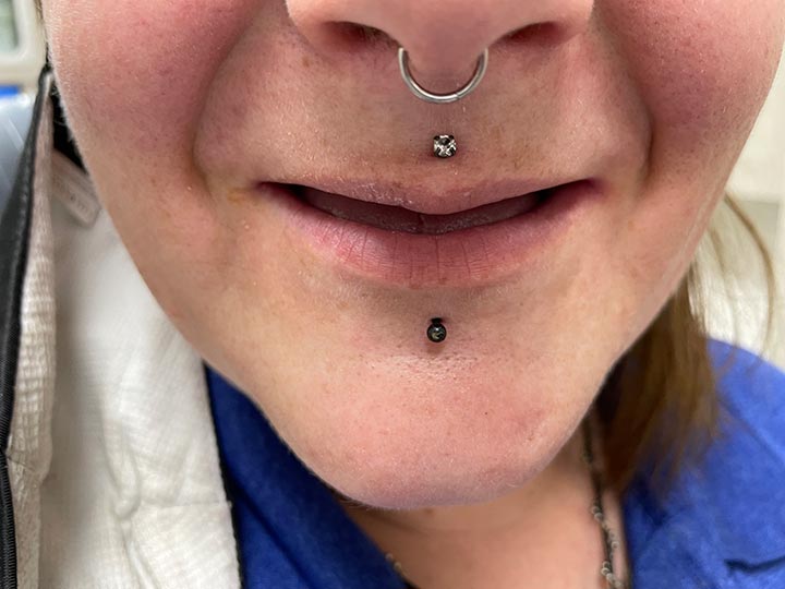 Columbia Basin Denture Care