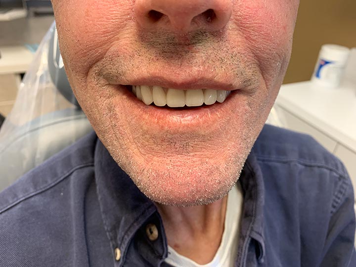 Our Results Columbia Basin Denture Care