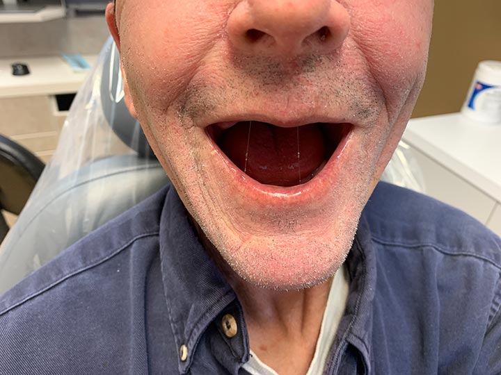 Our Results Columbia Basin Denture Care