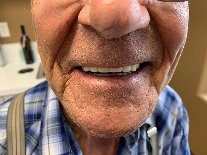 Columbia Basin Denture Care
