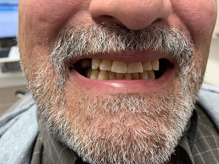 Columbia Basin Denture Care