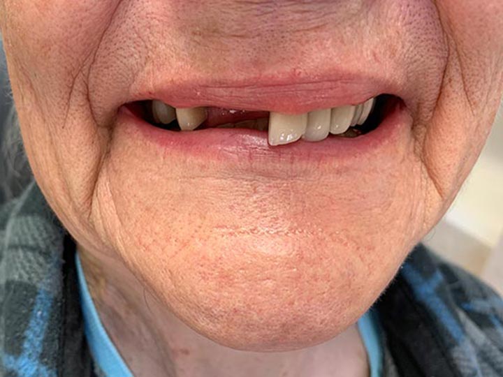 Our Results Columbia Basin Denture Care