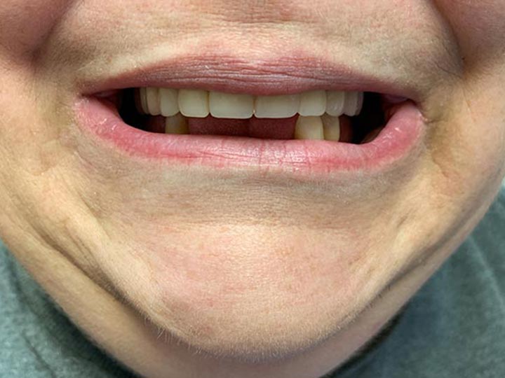 Our Results Columbia Basin Denture Care