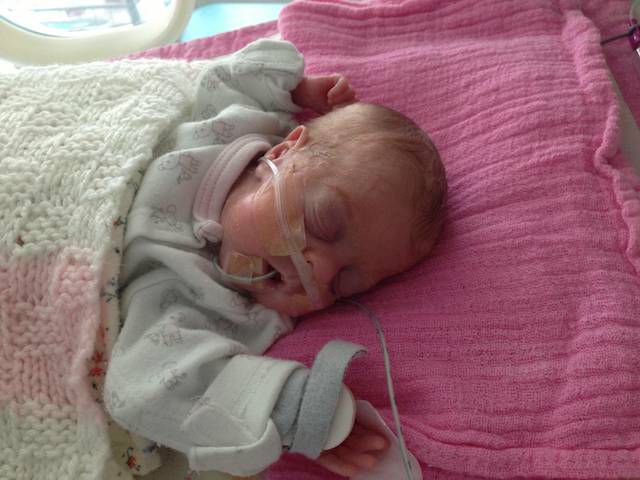 Father Documents His Premature Daughter's Fight for Survival from Birth