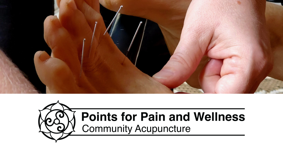 Community Acupuncture in Port Charlotte from Points for Pain and Wellness