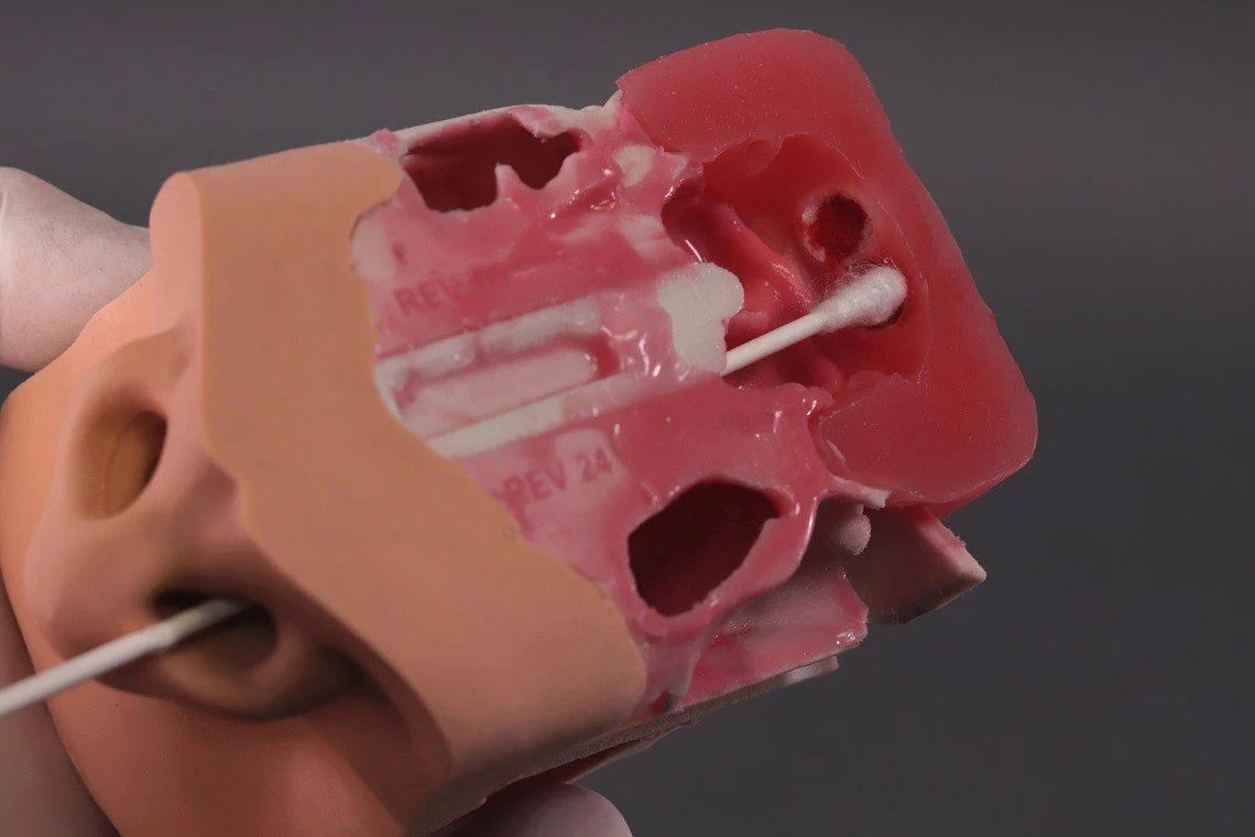 [SNaw] PHACON Sinus Patient “Meyer” nasal smear Phacon
