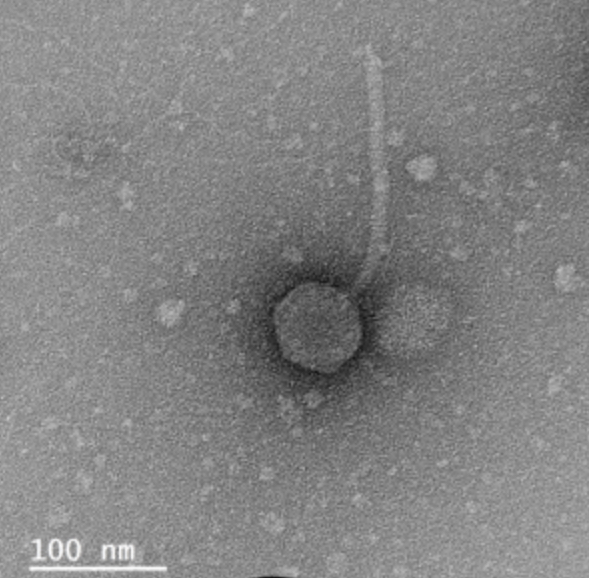 The Actinobacteriophage Database Phage Nunya