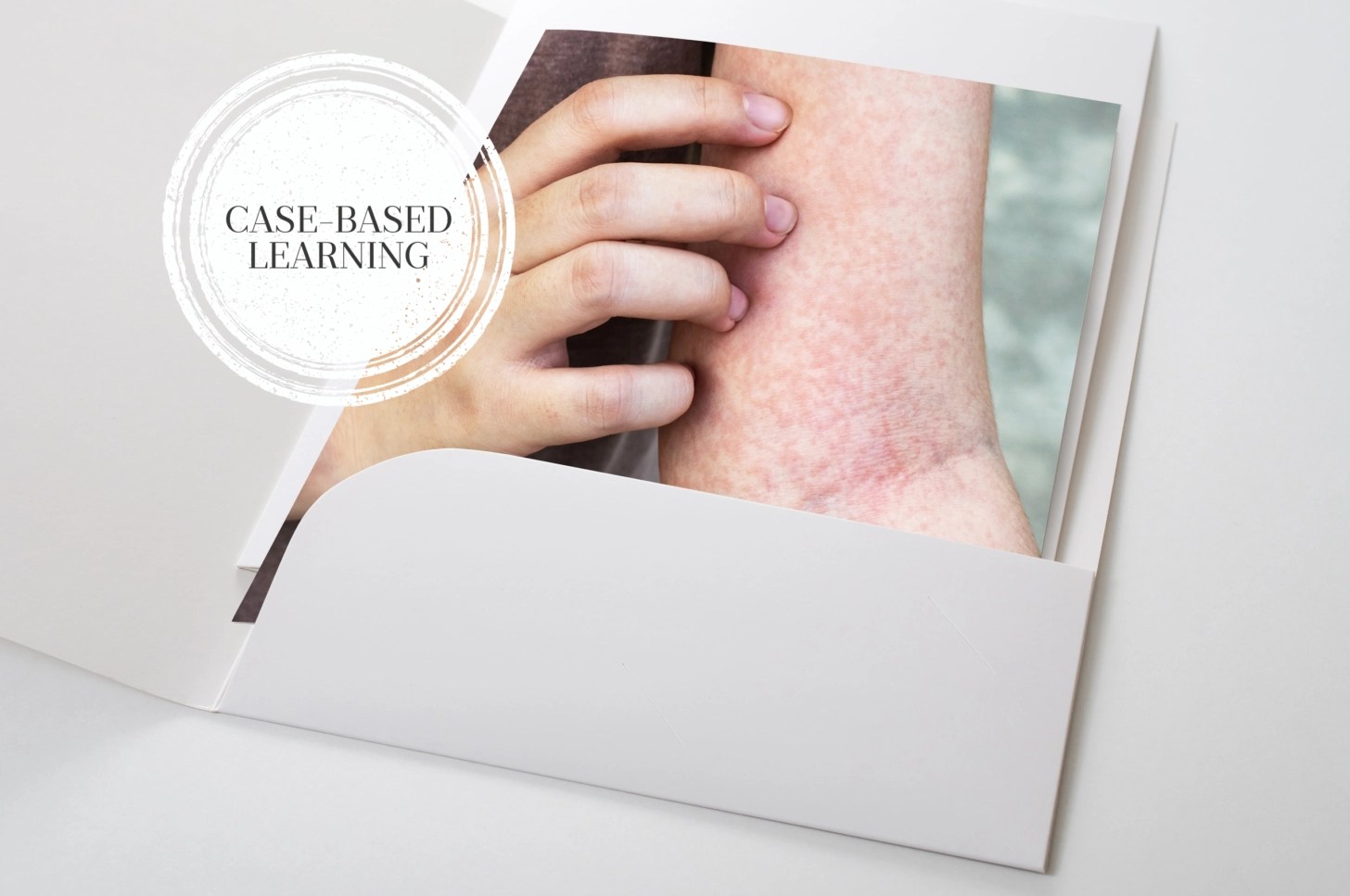 Casebased learning meningitis The Pharmaceutical Journal