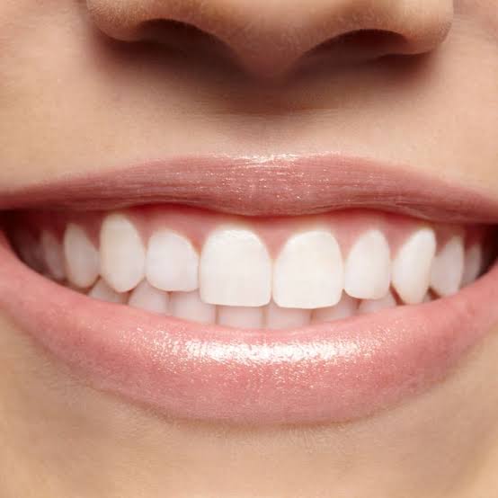 Dentists Associate Excess Refined Carbohydrate, Sugar to