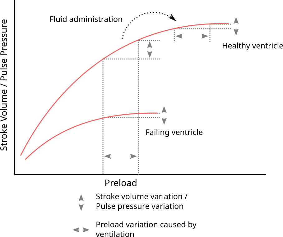2 Background Fluid Responsiveness Prediction During Surgery