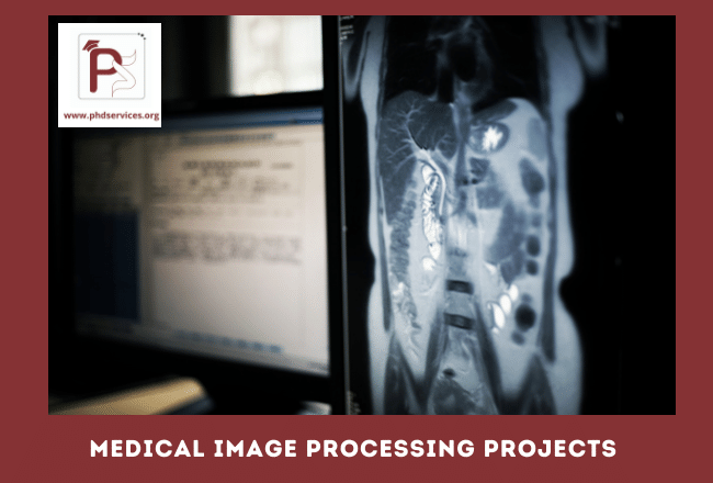 Research Phd Projects In Medical Image Processing Doctoral Thesis